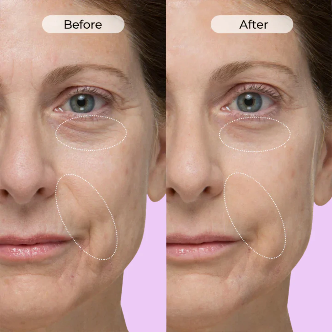 Anti-Wrinkle & Dark Circle Eye Cream with Roller Massager