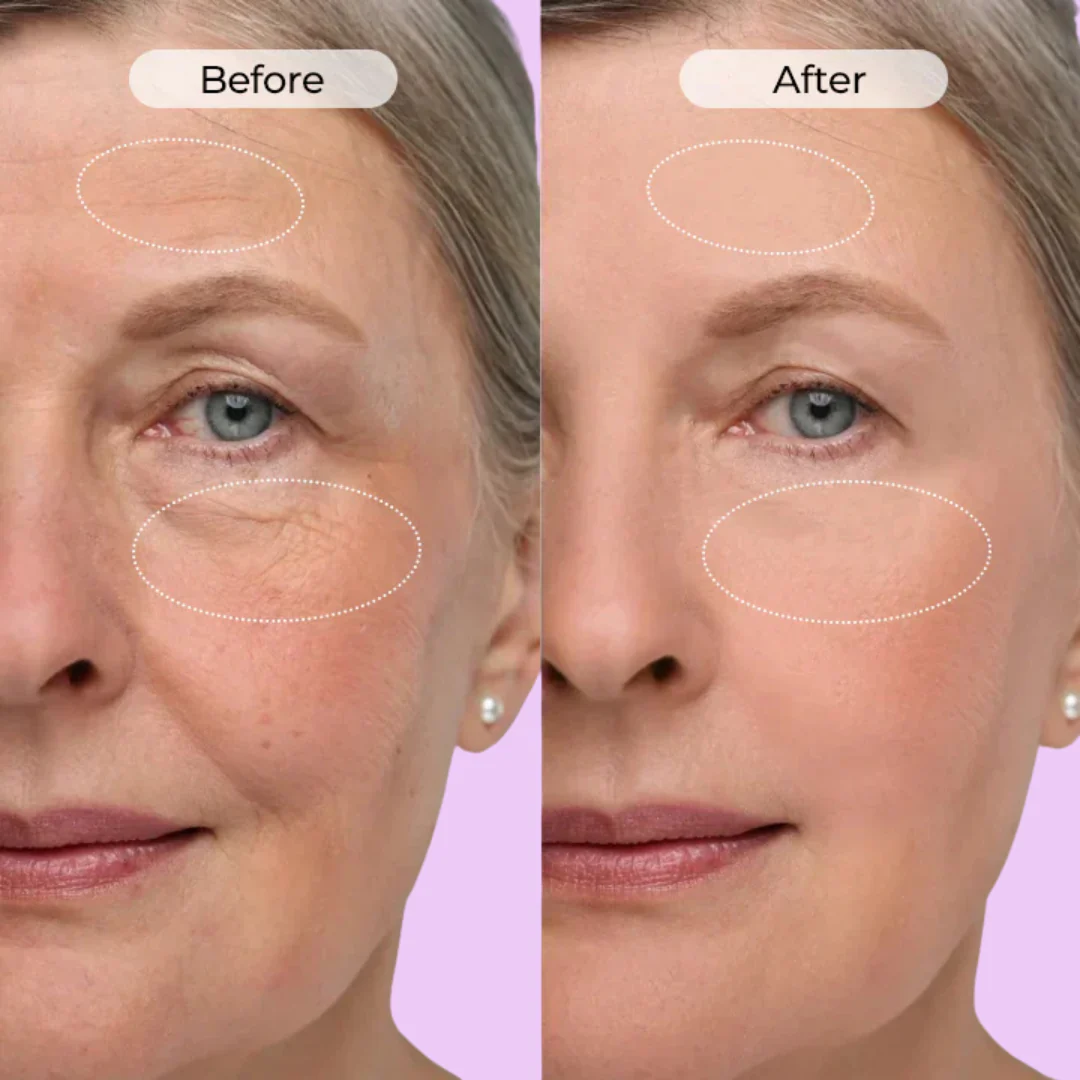 Anti-Wrinkle & Dark Circle Eye Cream with Roller Massager
