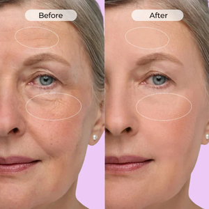 Anti-Wrinkle & Dark Circle Eye Cream with Roller Massager