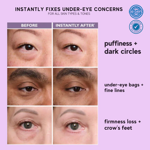 Anti-Wrinkle & Dark Circle Eye Cream with Roller Massager