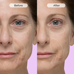 Anti-Wrinkle & Dark Circle Eye Cream with Roller Massager